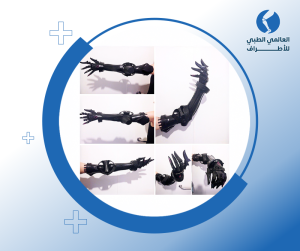 أنواع الأطراف الصناعية من مفصل الكتف