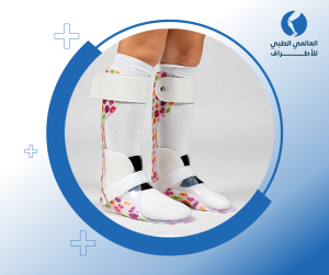 تركيب الجبائر الطبية البلاستيكية للساقين