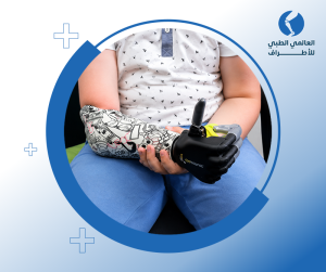 أسعار الأطراف الصناعية والأجهزة التعويضية