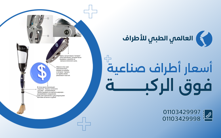 أسعار اطراف صناعية فوق الركبة