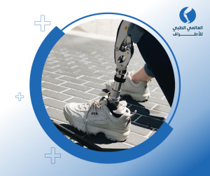 اطراف صناعية فوق الركبة
