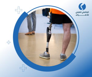 الأجهزة التعويضية