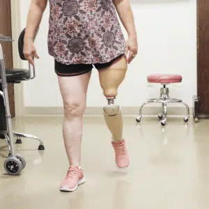 الأجهزة التعويضية والاطراف الصناعية 