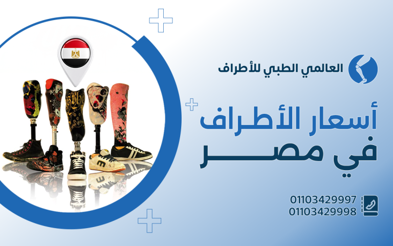 أسعار الأطراف في مصر