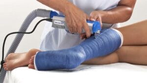 سعر الجبس البلاستيك