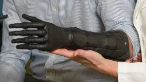 الاطراف الصناعية والاجهزة التعويضية