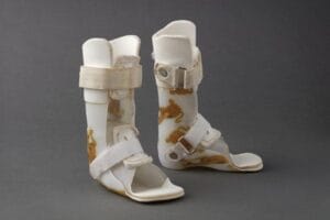 أنواع الجبائر الطبية