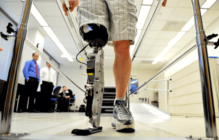 أسعار الأطراف الصناعية الألمانية