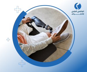 الأطراف الصناعية المتطورة