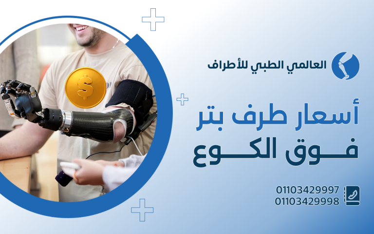 أسعار طرف بتر فوق الكوع