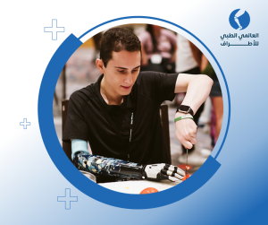 الطرف الصناعي فوق الكوع