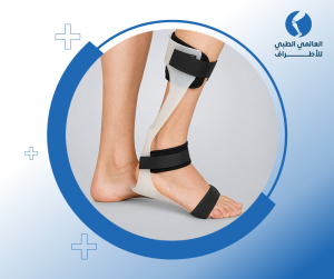 الجبيرة البلاستيكية للقدم