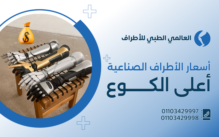 أسعار الأطراف الصناعية أعلى الكوع