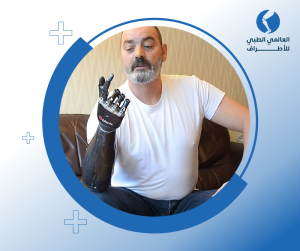طرف صناعي أعلى الكوع