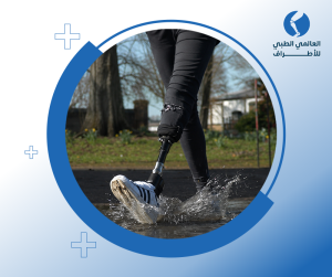 أحدث طرف صناعي
