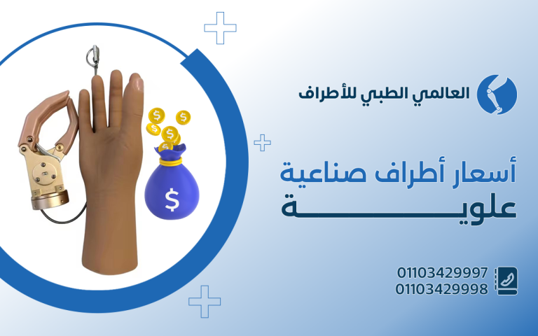 أسعار اطراف صناعية علوية في مصر