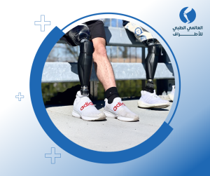 أنواع الأطراف الصناعية السفلية