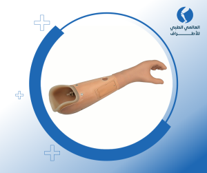 أنواع الأطراف الصناعية تحت الكوع