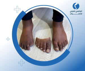 اطراف صناعية تجميلية
