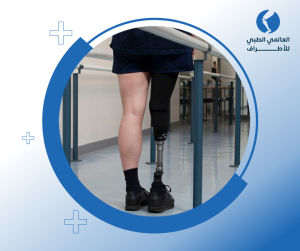 اطراف صناعيه تحت الركبة