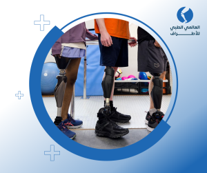 الأطراف الصناعية الحديثة