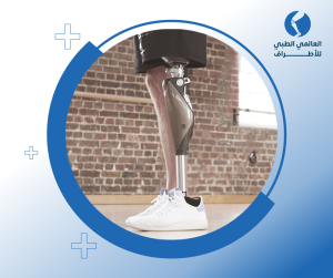 الأطراف الصناعية عالية الجودة