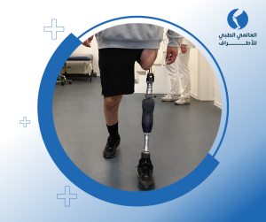 الأطراف الصناعية للرياضيين