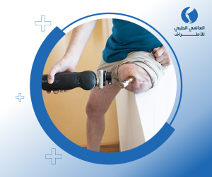 زراعة الأطراف الصناعية للرياضيين