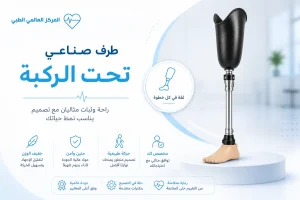 اسعار الاطراف الصناعية