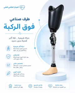 اسعار الطرف الصناعي فوق الركبة 