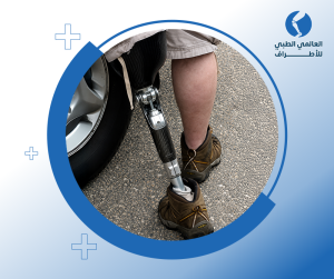 عروض بيع أنواع الأطراف الصناعية