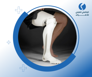 مميزات التقنيات الحديثة بالأطراف الصناعية