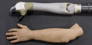 الاطراف الصناعية الالمانية