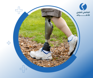 أسعار الأطراف الصناعية 1