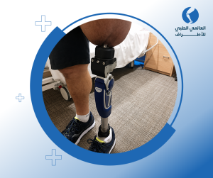 أنواع الأطراف الصناعية