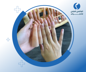 اصابع صناعية لليد والقدم