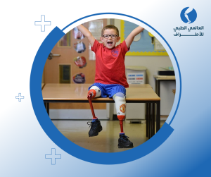 اطراف صناعية للاطفال 1