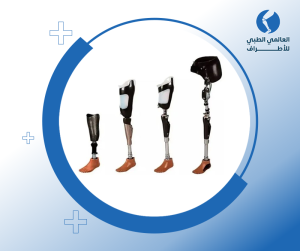 اطراف صناعية من مفصل الحوض