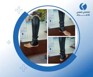 الطرف التكميلي للقدم