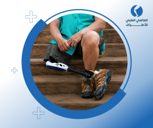 الطرف الصناعي فوق الركبة
