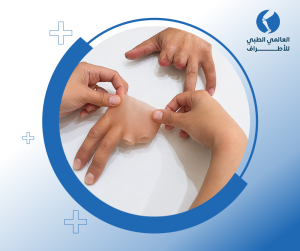 تركيب أصابع صناعية لليد