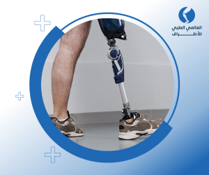 أسعار الرجل الصناعية