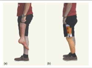 تشوهات خلقيه