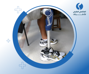 الاطراف الصناعية من شركة اوتوبوك الالمانية