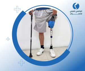 سعر الطرف الصناعي فوق الركبة