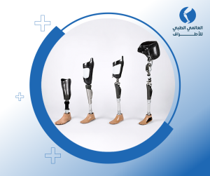 أسعار الأطراف الصناعية