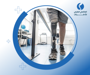 أسعار الطرف الصناعي