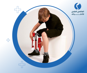 انواع الاطراف الصناعية