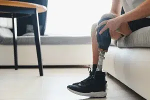 اسعار الرجل الصناعية
