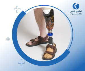 عروض اسعار الرجل الصناعية